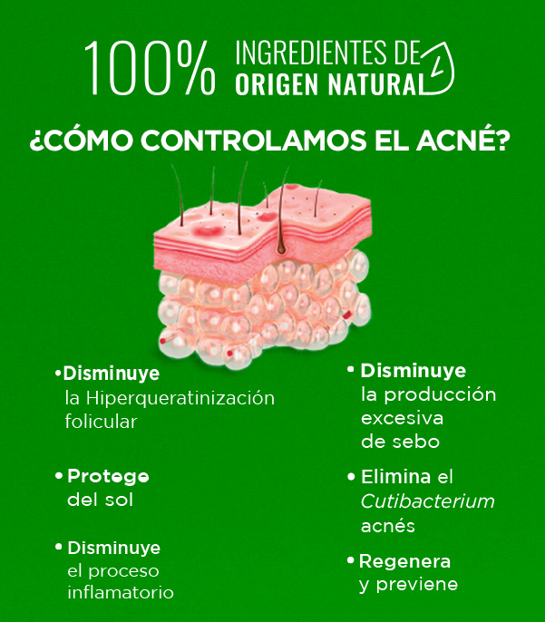 Beneficios antiacné