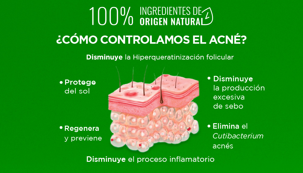 Beneficios antiacné