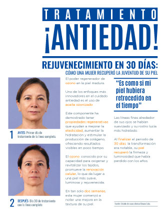 Caso de éxito crema anti age