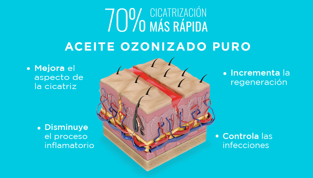 Beneficios del aceite ozonizado